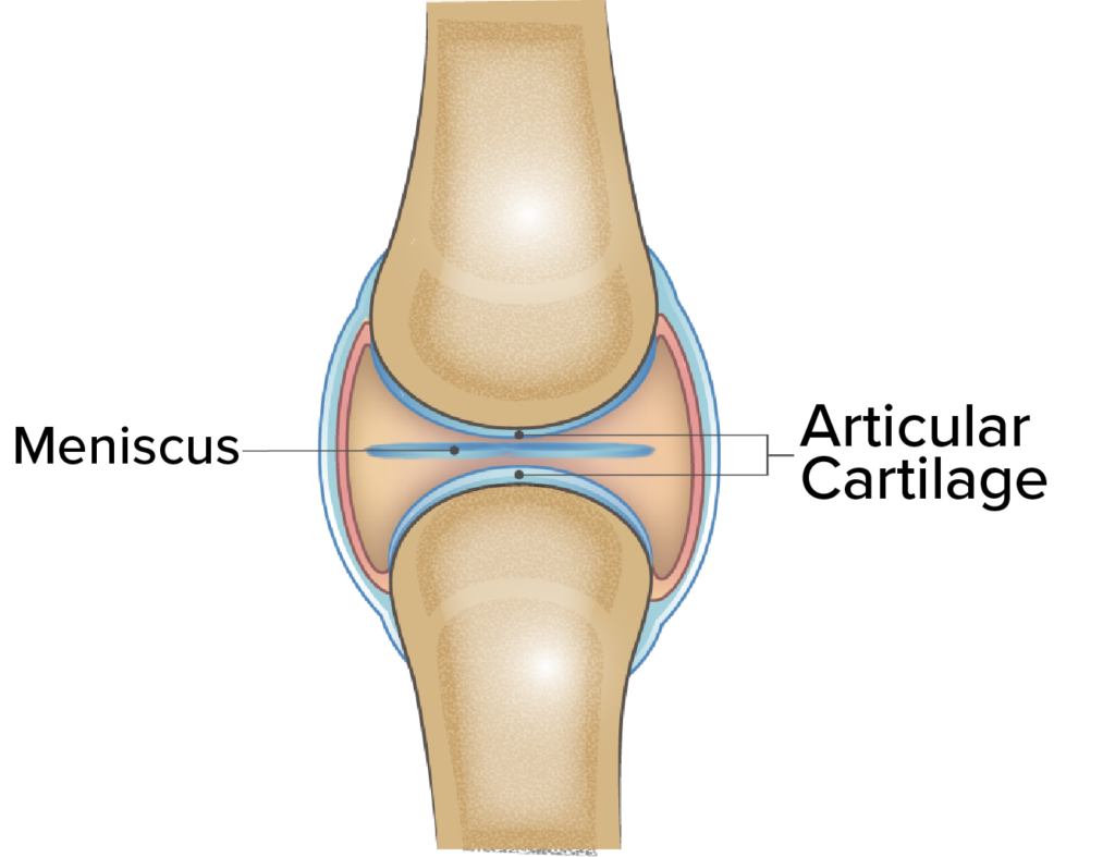 Bone On Bone Knee Pain What You Need To Know