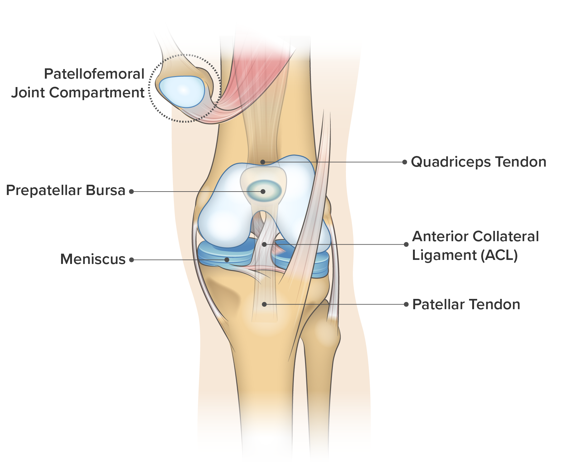 Patellar tendonitis and patellar tendinopathy