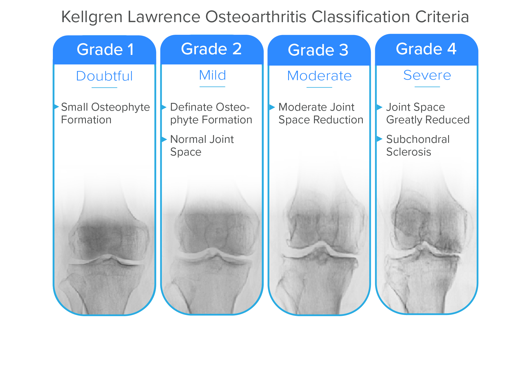 Osteoarthritis radiology findings
