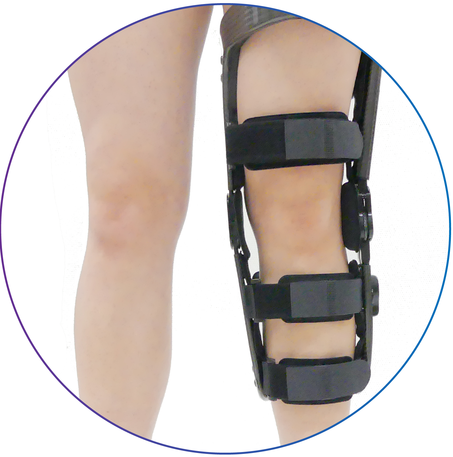 Choosing the Right Knee Brace: What You Need to Know