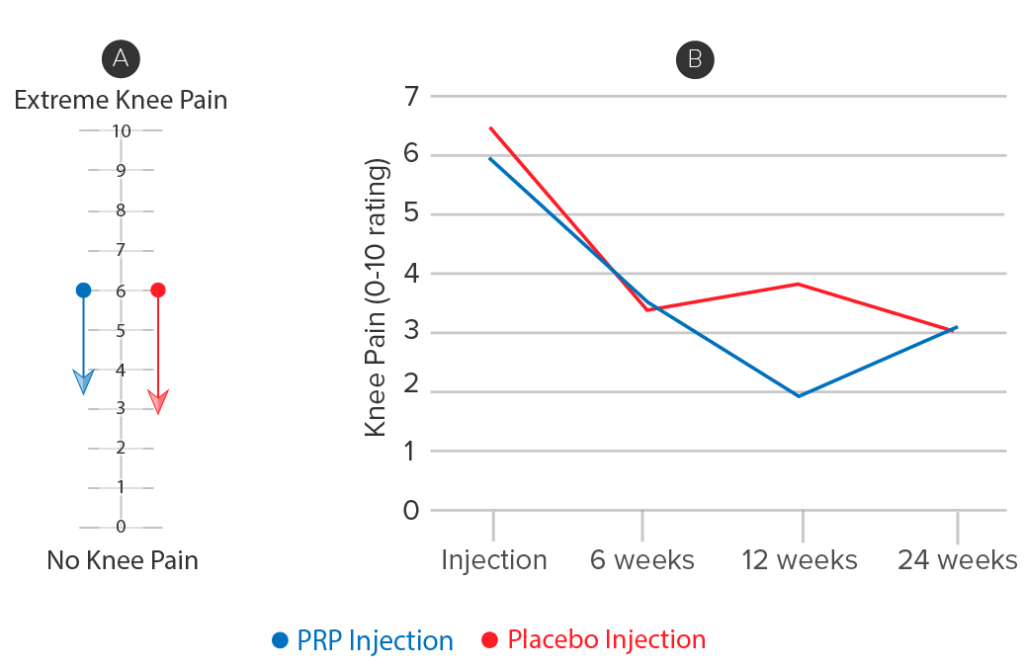 Graphs showing that placebo injections are equivalent in effectiveness to PRP